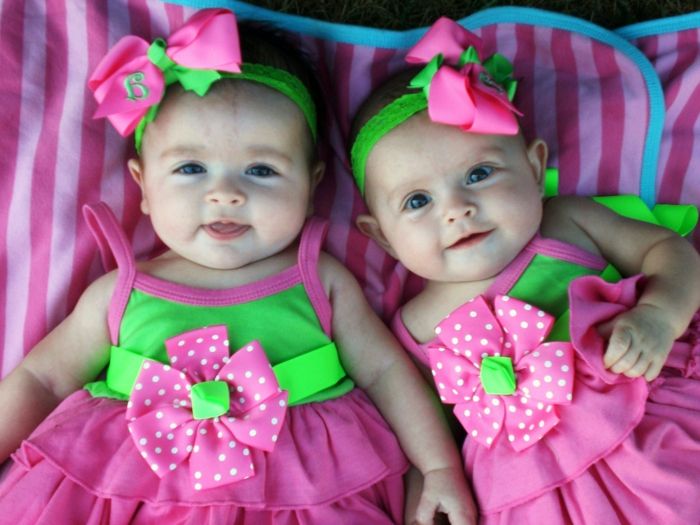 enäggstvillingar-bra-baby-girl-rosa klänning